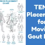 TENS Placement Complicated in Gout