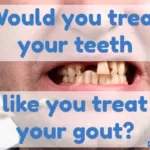 Gout and Teeth