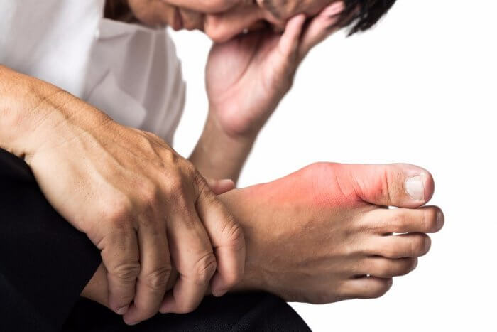 How long does gout flare up last?