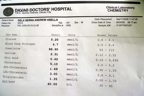 Dangerous Normal Uric Acid Test Result