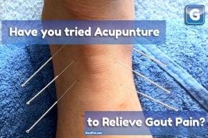 Does Gout Pain and Acupuncture work for you?