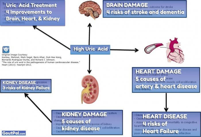 How Can Gout Kill You?