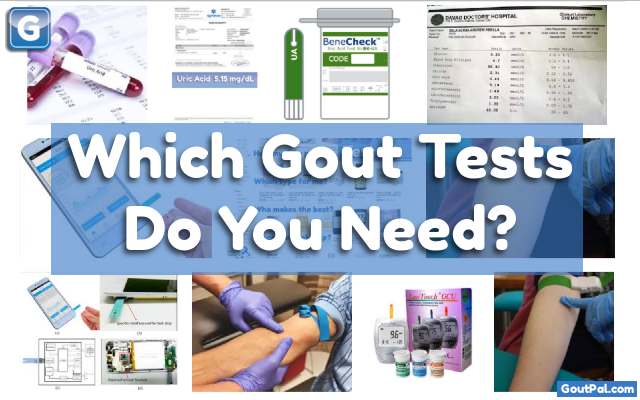 Which Gout Tests Do You Need?